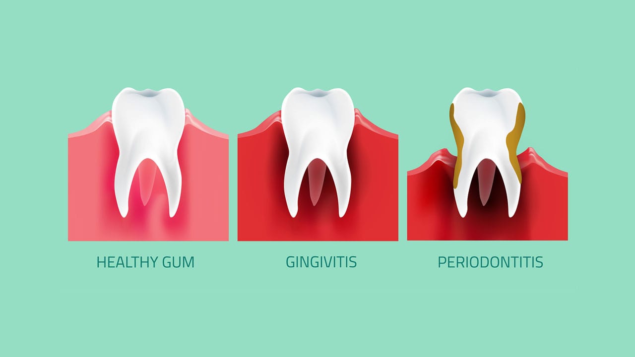 Westmont Dentist